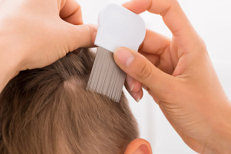 The Head Lice Life Cycle (And How You Can Beat It)