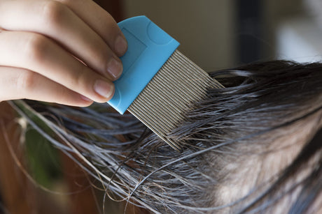Dimethicone Head Lice Treatments: End the Nit Itch